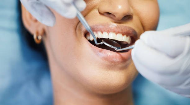 Best Broken or Cracked Tooth Emergency Dentist in Weston, MO
