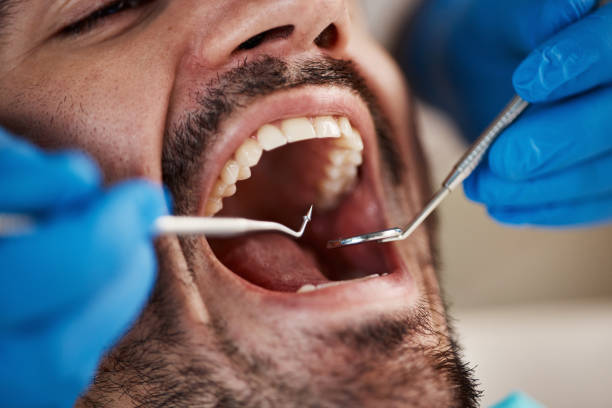 Best Emergency Dentist for Knocked-Out Tooth in Weston, MO